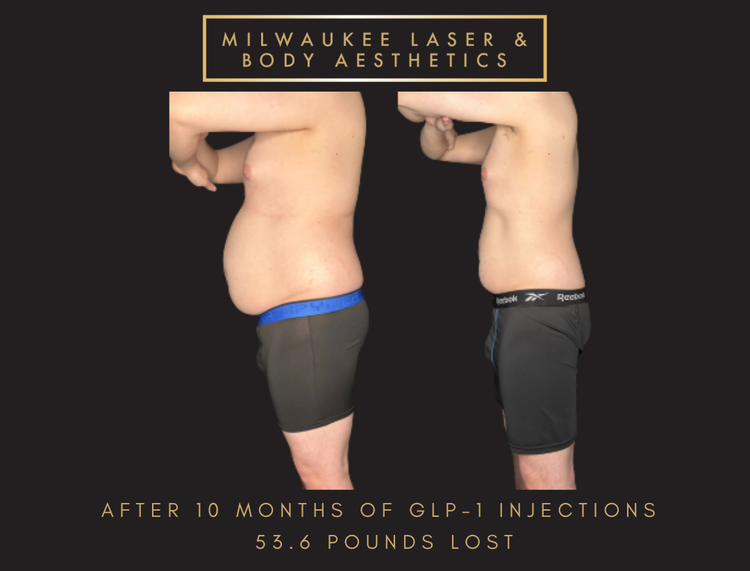 Weight Loss - 10 months before and after image