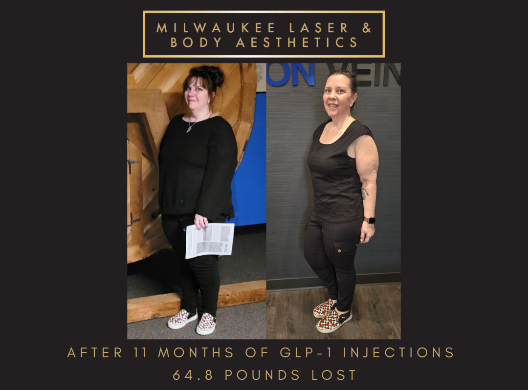 Weight Loss - 11 months before and after image