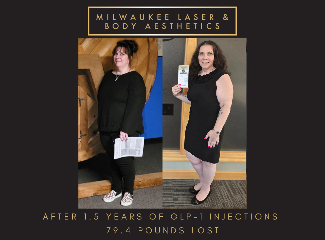 Weight Loss - 15 years before and after image