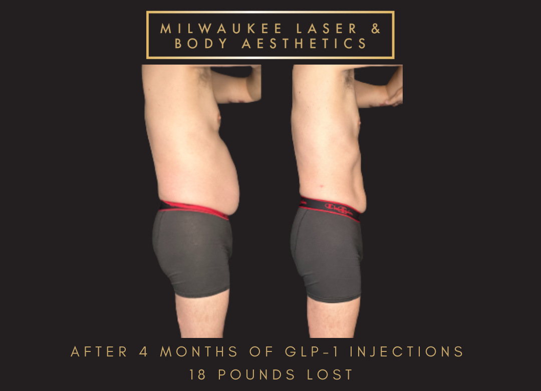 Weight Loss - 4 months before and after image