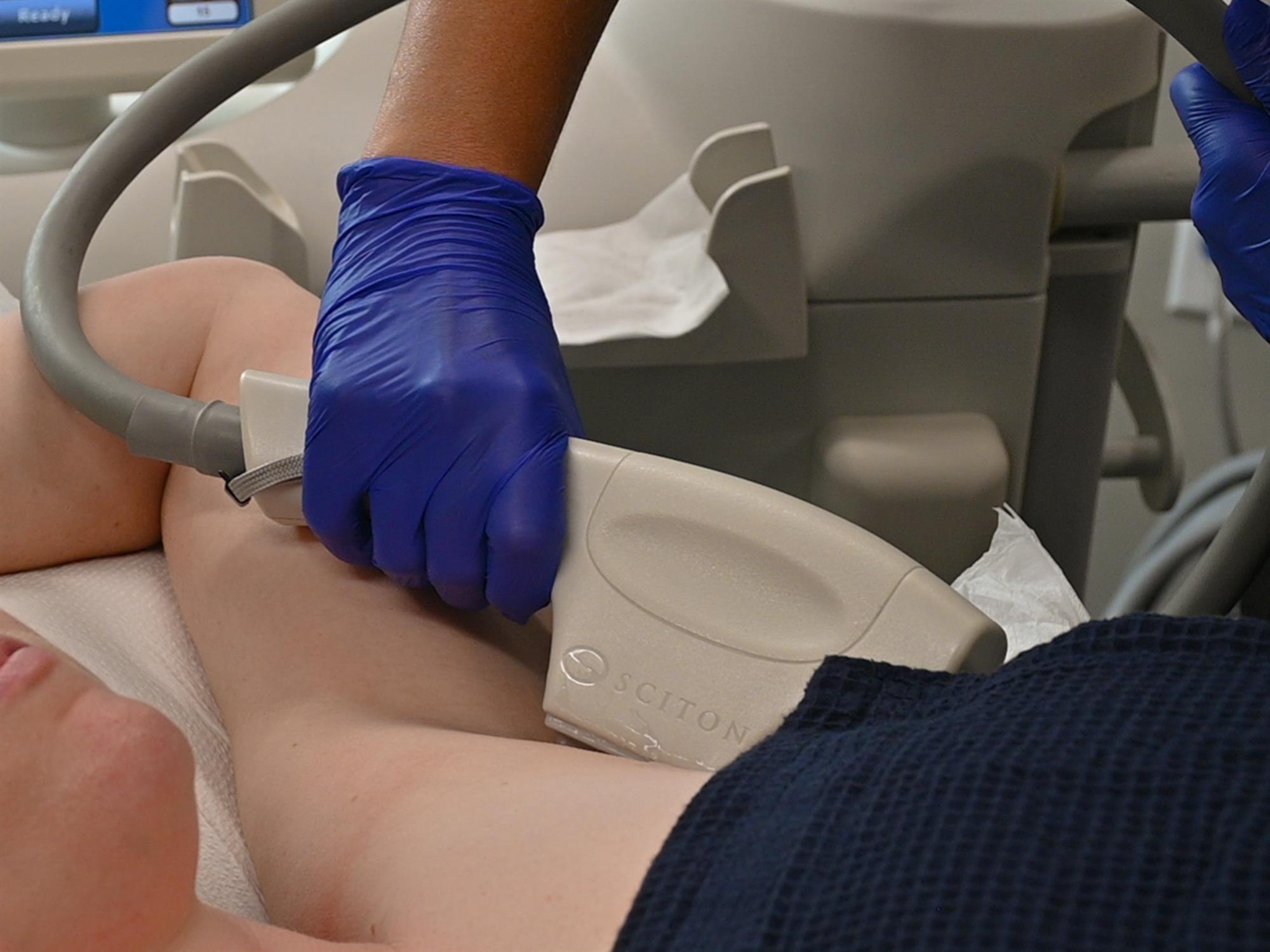 what to expect during your Milwaukee laser hair removal treatment