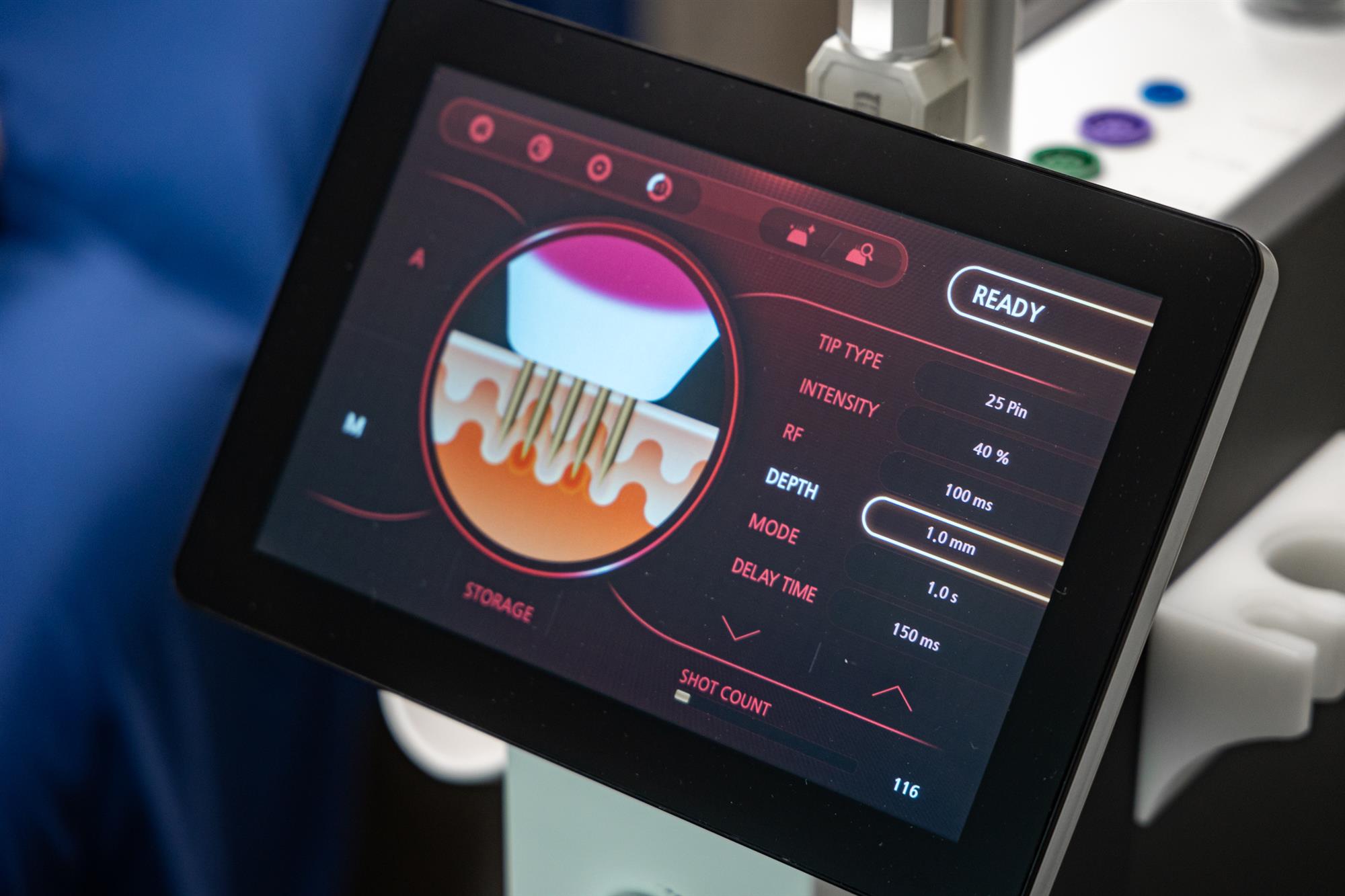 Smoother Skin Without Surgery: RF Microneedling for Fine Lines